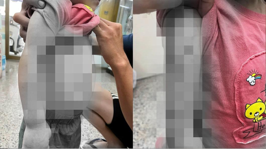 女童渾身是傷。(圖/翻攝自爆料公社)