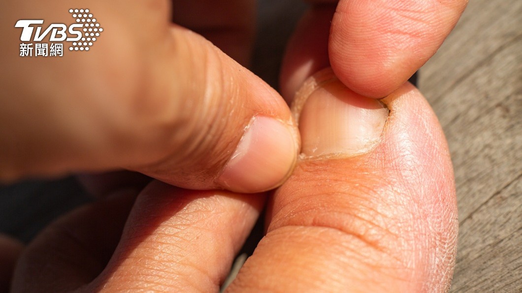 原PO意外驚見男友有摳腳皮拿來吃的怪癖。（示意圖／shutterstock達志影像）
