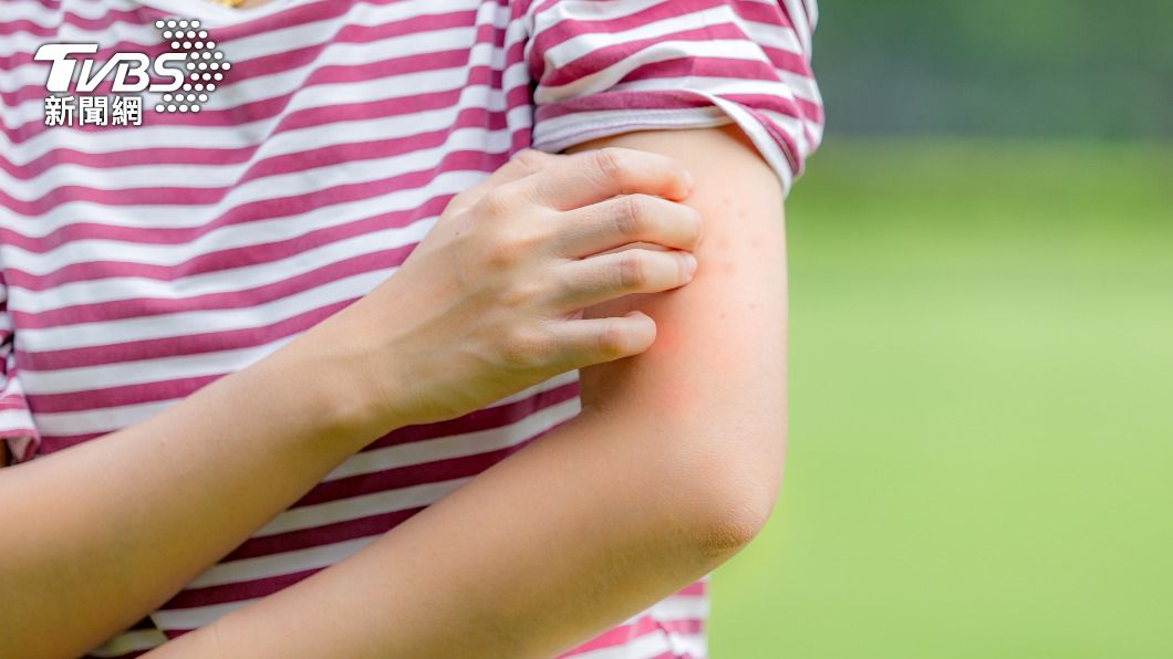 家長突要求調監視器…竟因「孩子被蚊叮」 網傻眼:讓他看!