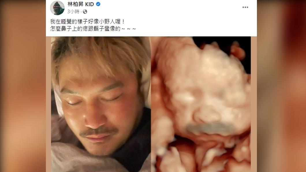 KID再貼出兒子超清晰超音波。(圖/翻攝自KID林柏昇臉書)