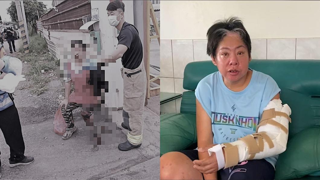 女工遇職災斷臂!家境陷入困境 嘆:生兒計畫「想都不敢想」