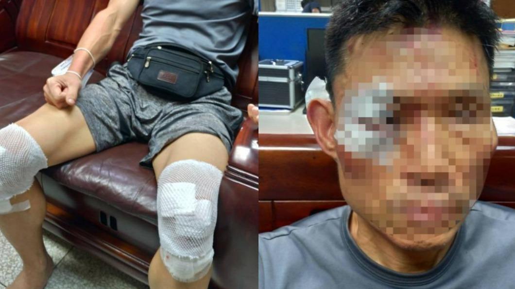 男子臉部、手腳多處受傷。(圖/民眾提供)