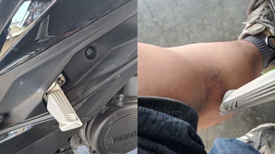 一名網友分享自己被飛旋踏板弄到小腿肚瘀青讓許多民眾頗有共鳴。(圖/翻攝自臉書社團「爆廢公社公開版」)