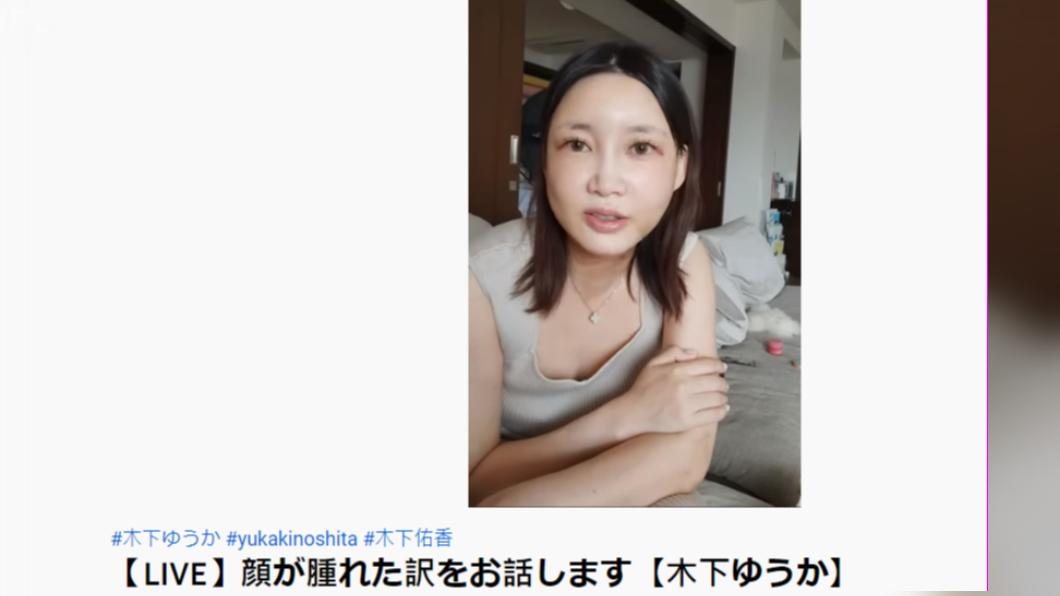 木下9月開直播,表示自己做了醫美。(圖/翻攝自木下佑香Youtube頻道)