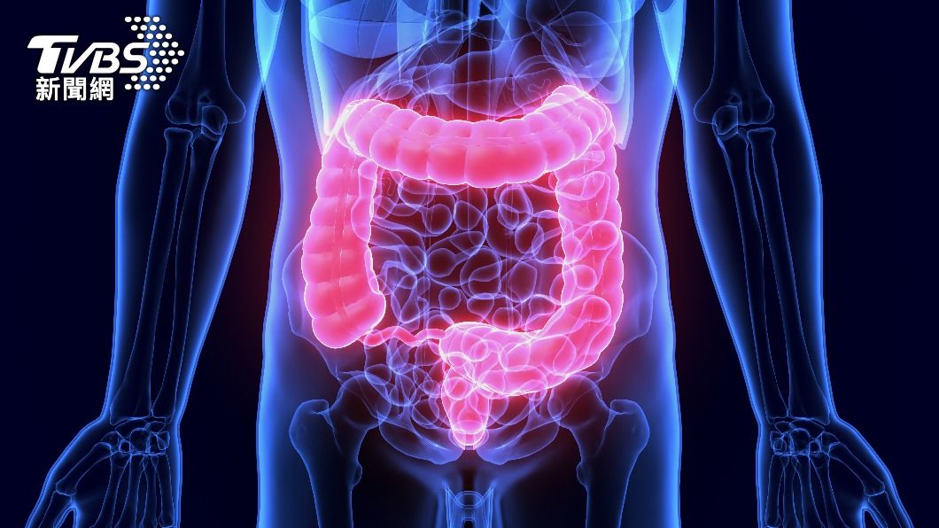 醫曝大腸癌7徵兆 「最後1項」最可怕:多半已晚期