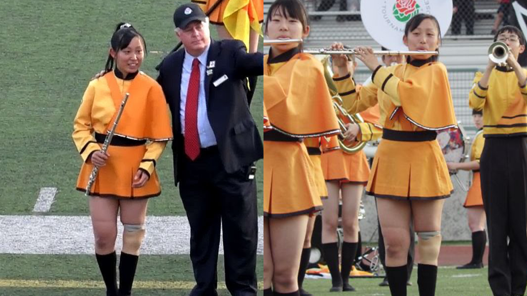 深蹲吹奏難不倒!橘色惡魔「義肢女孩」身分曝 網噴淚跪看