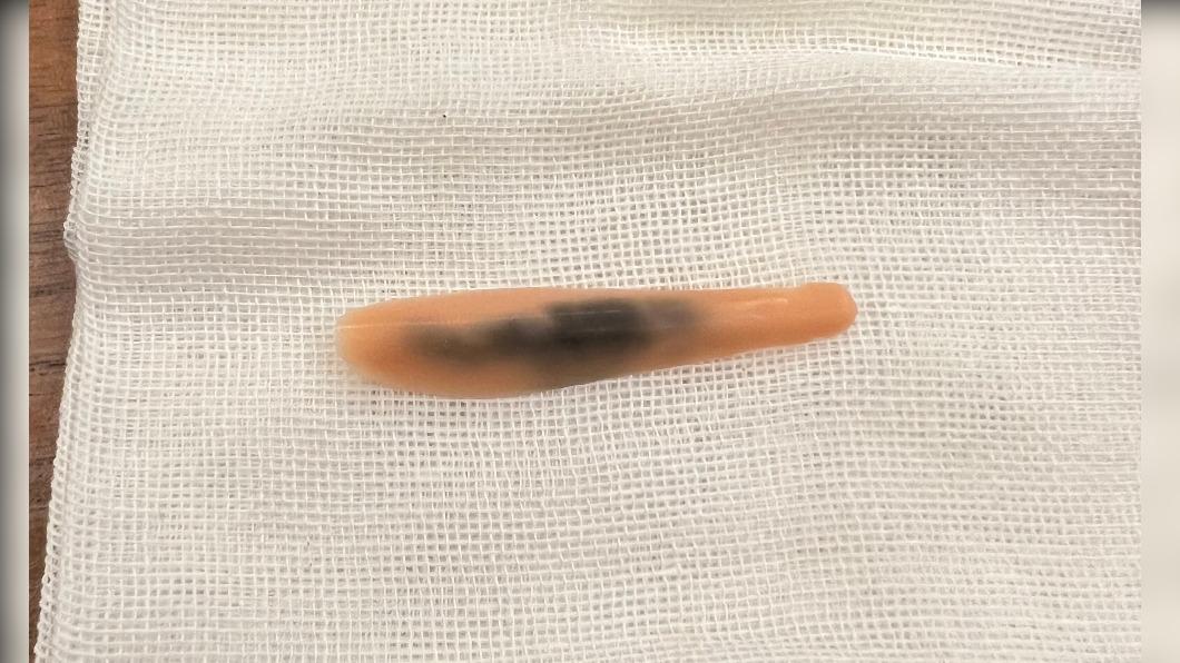 人工美女注意!打雷射竟鼻子發青 原來是疏忽這件事