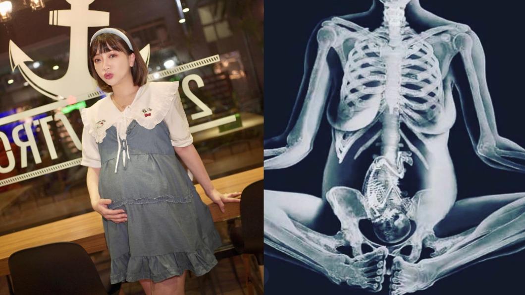 下個月就生了 女星突公開「全身透視照」被罵:能照X光?
