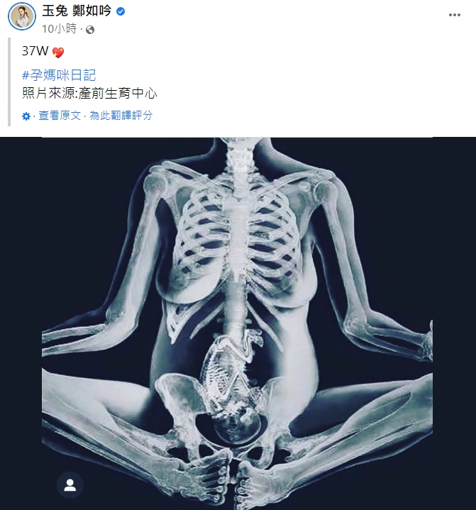 玉兔貼出全身X光照。（圖／翻攝自玉兔臉書）