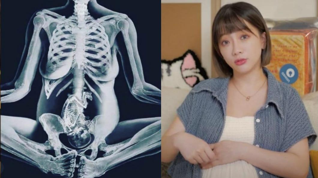 玉兔懷孕PO「寶寶透視照」被罵慘 經紀人回應了