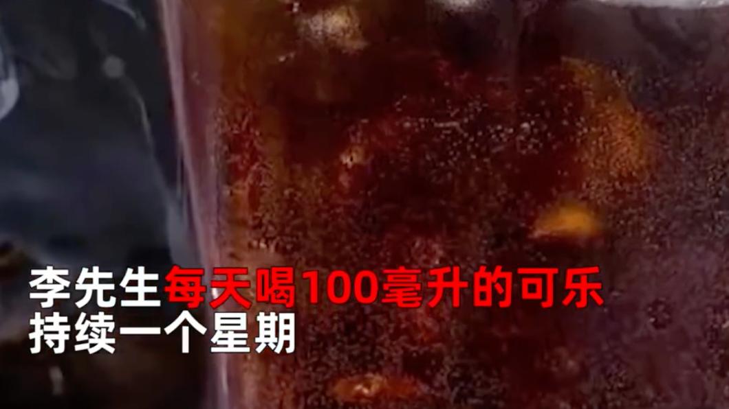 李男每天喝100毫升可樂。（圖／翻攝自微博）