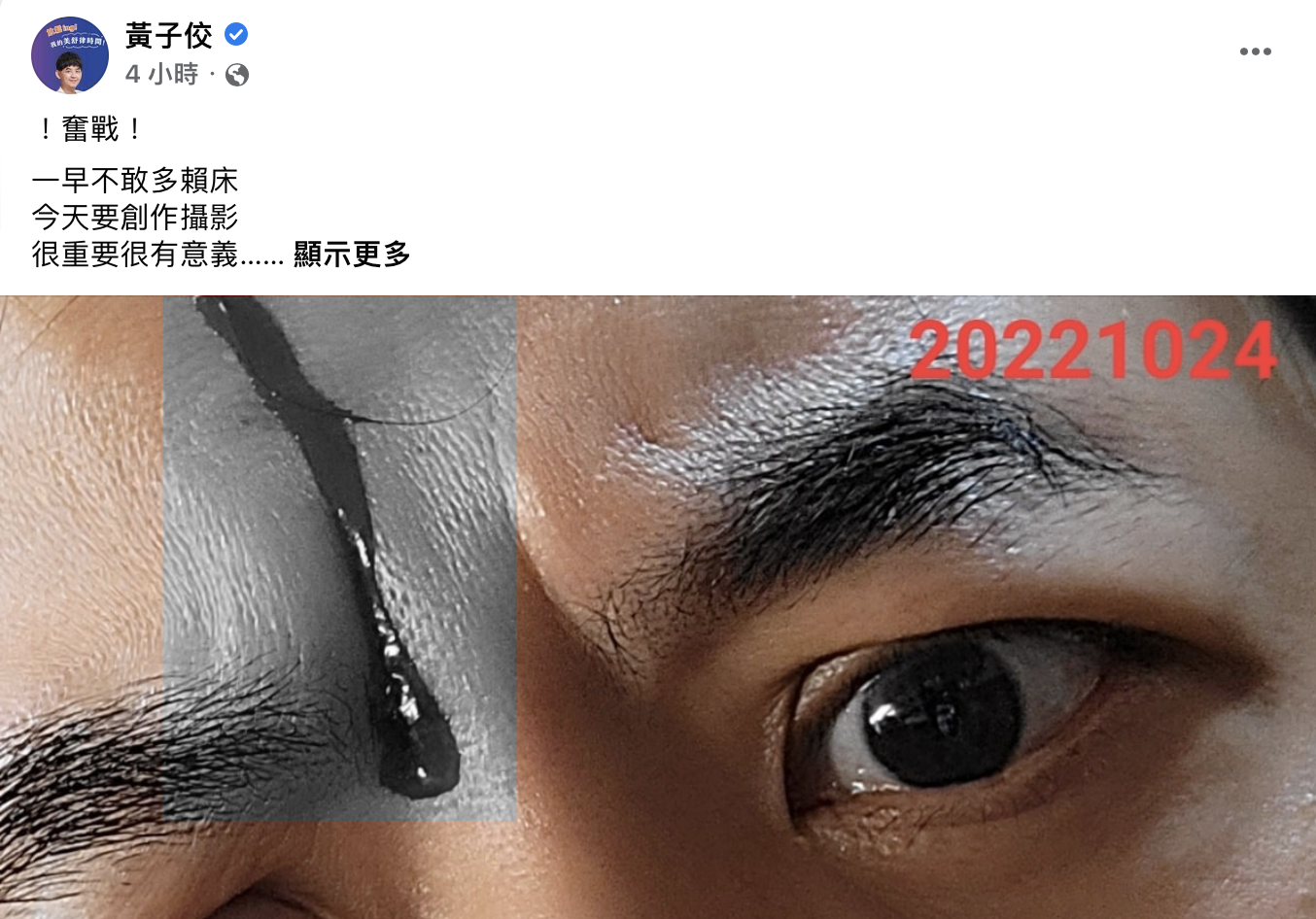黃子佼敘述自己頭受傷的過程以及傷勢。(圖/翻攝自黃子佼臉書)