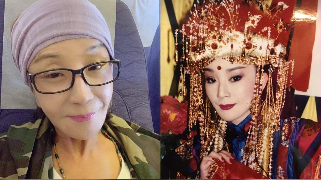 資深女星驚爆病危「90%危險」!急籌十萬醫藥費 周遊曝病況