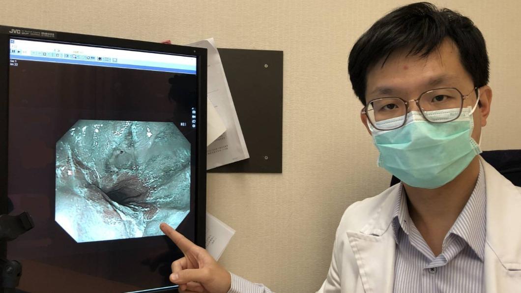 30歲女每天起床「嘴巴鹹苦」以為確診 味覺異常竟是這病惹禍
