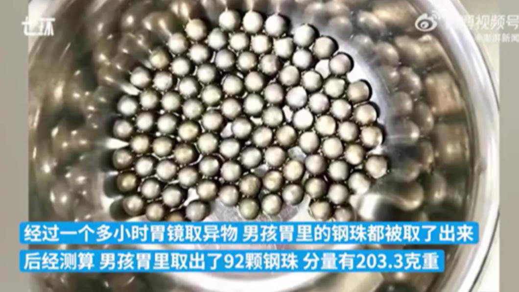 大陸10歲男童吞下百顆鋼珠被送醫急救。(圖/翻攝自澎湃新聞影音)
