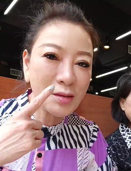 楊繡惠左眼冒血絲。（圖／翻攝自楊繡惠臉書）