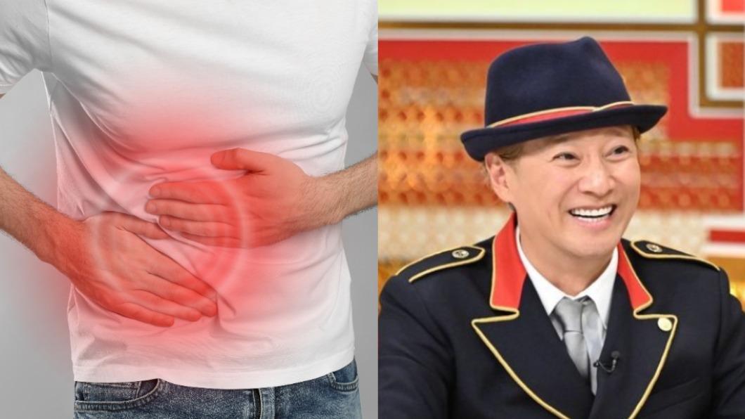 男星「驚罹盲腸癌」病況不理想!醫揭致死率 腹痛快就醫