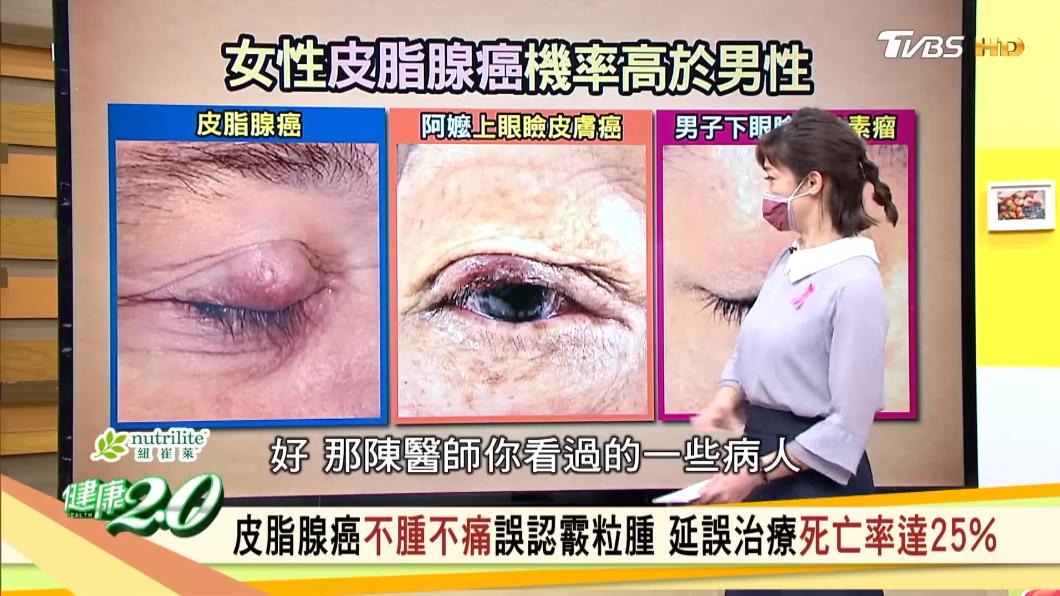 阿嬤腫瘤已出現潰爛。(圖/TVBS《健康2.0》)