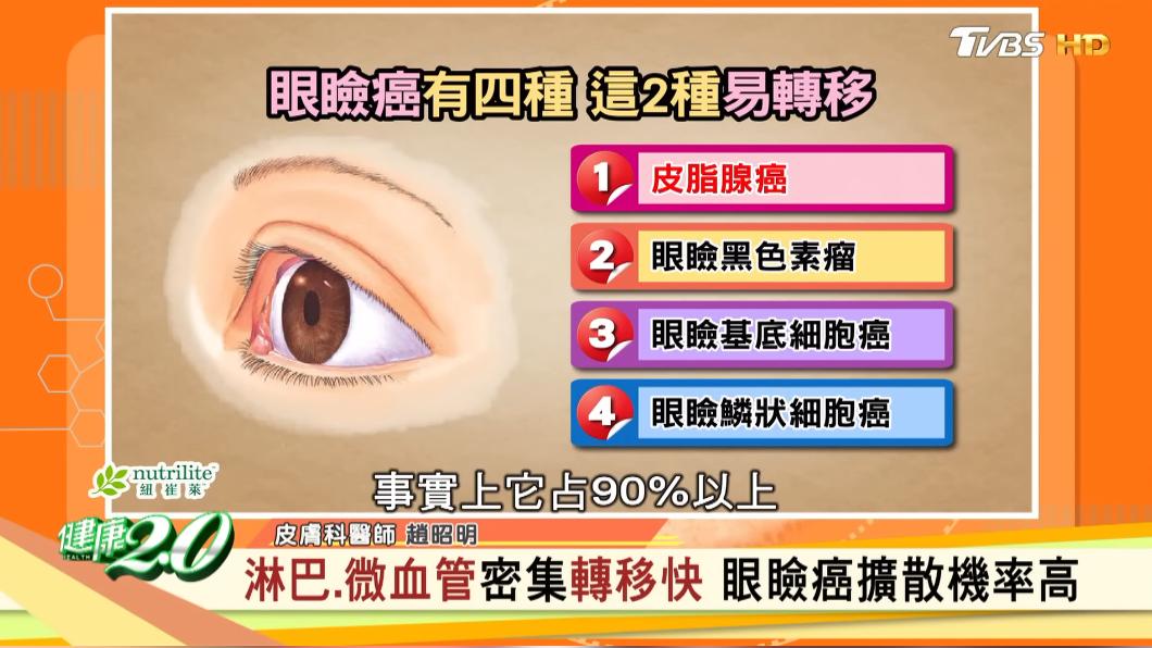 眼瞼癌細胞擴散機率高。(圖/TVBS《健康2.0》)