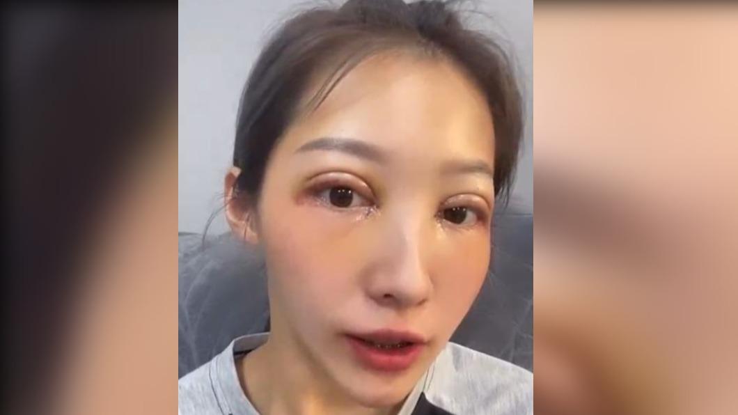 歐菈曾分享自己割雙眼皮後的模樣。(圖/翻攝自歐菈IG)