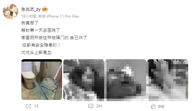 張兆藝家中廁所玻璃門突爆裂,女兒和老公遭炸傷。(圖/翻攝自張兆藝微博)