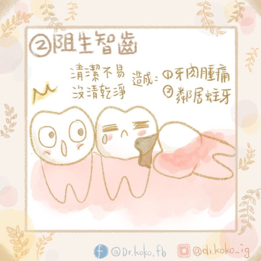智齒長成橫的是常見的情況。(圖/翻攝自柯佩伶臉書)