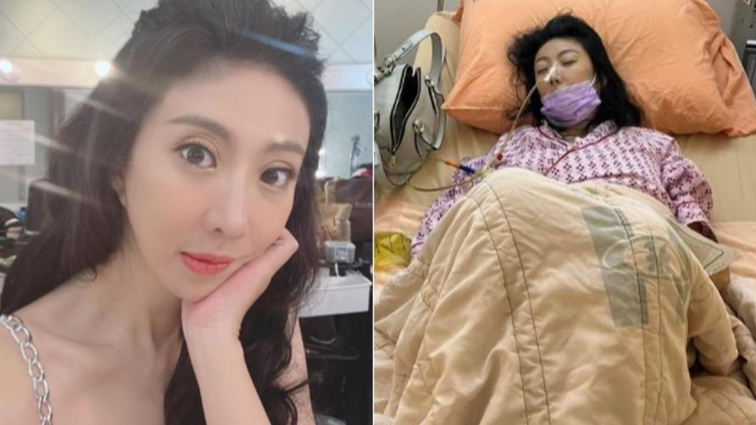 53歲本土女星驚傳中風!病危送醫「開腦引流續命」現況曝光