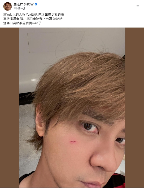 羅志祥不小心受傷。(圖/翻攝自羅志祥臉書)