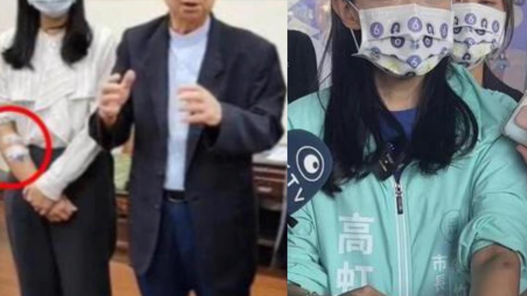 高虹安「點滴瘀青」遭諷不連戲！競辦發言人：兩手都查才甘願？