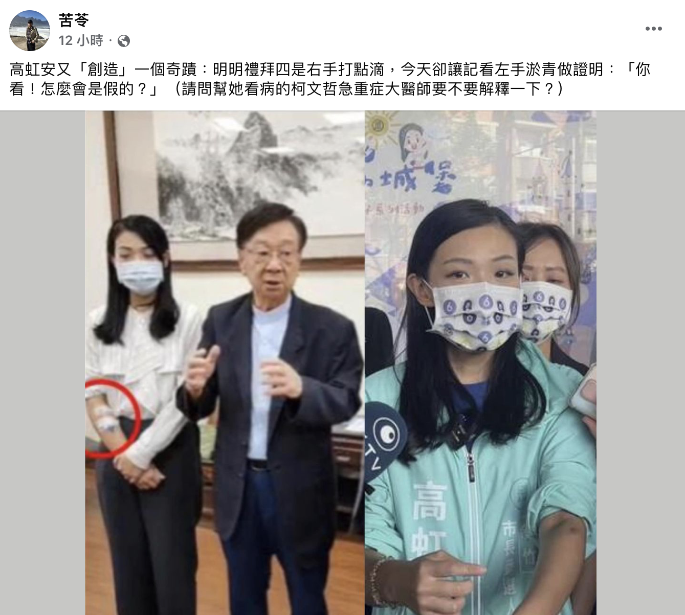 苦苓發文嘲諷高虹安瘀青。(圖/翻攝自苦苓臉書)