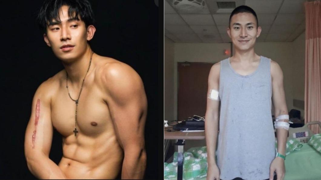 28歲男星罹骨癌!「腫瘤吃掉半根骨頭」崩潰:痛如骨裂