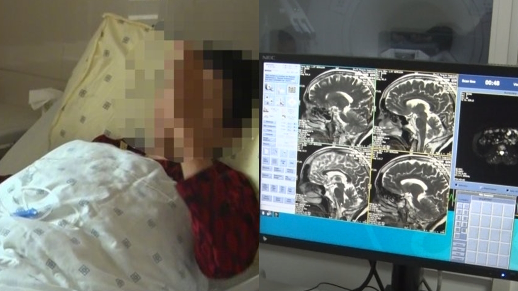 鄰桌神秘男驚語「妳長腦瘤」!一查真罹病 危險5特徵當心