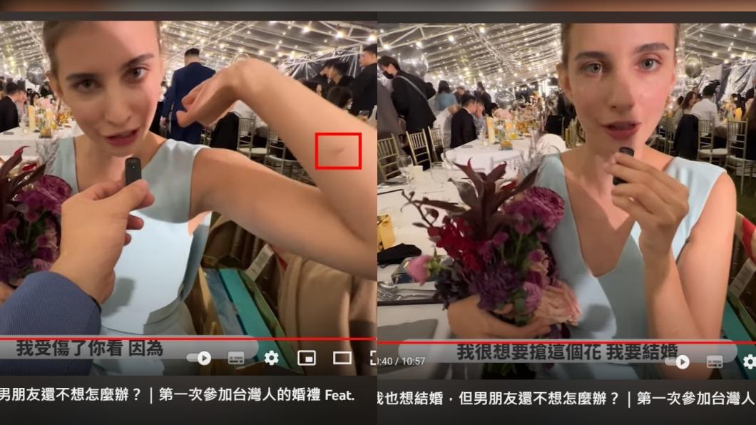 佳娜露出為了搶捧花而受的傷,透露真的很想結婚。(圖/翻攝自佳娜老師機 YouTube)