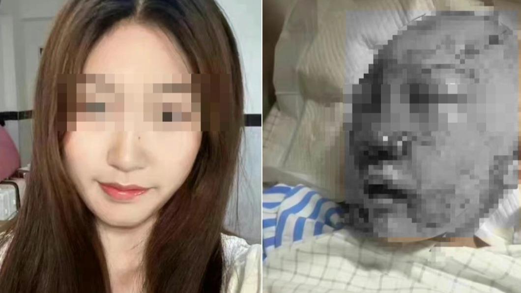 上公廁遭陌生男磚頭猛砸!20歲網美「挖眼拔舌」7顆牙全斷