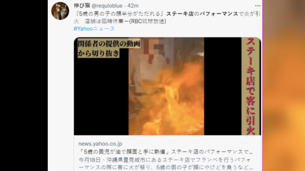 點火秀意外造成男童半張臉灼傷。(圖/翻攝自推特)