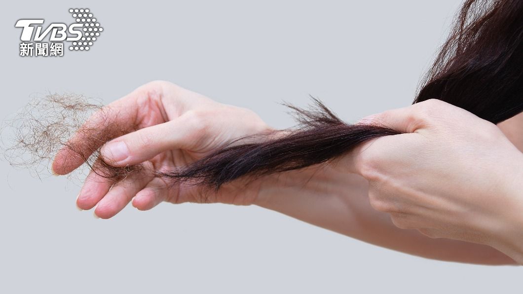 休止期落髮是一種很常見、呈現廣泛性的落髮。(示意圖/shutterstock達志影像)