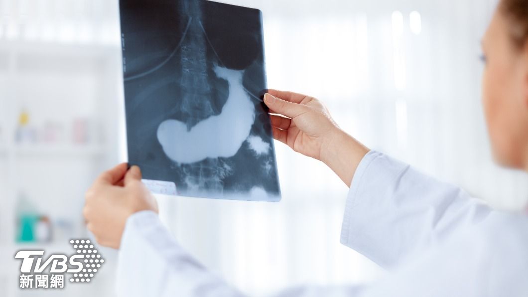 50歲男常腰痠「按摩都沒用」 醫檢查嘆:癌王第三期