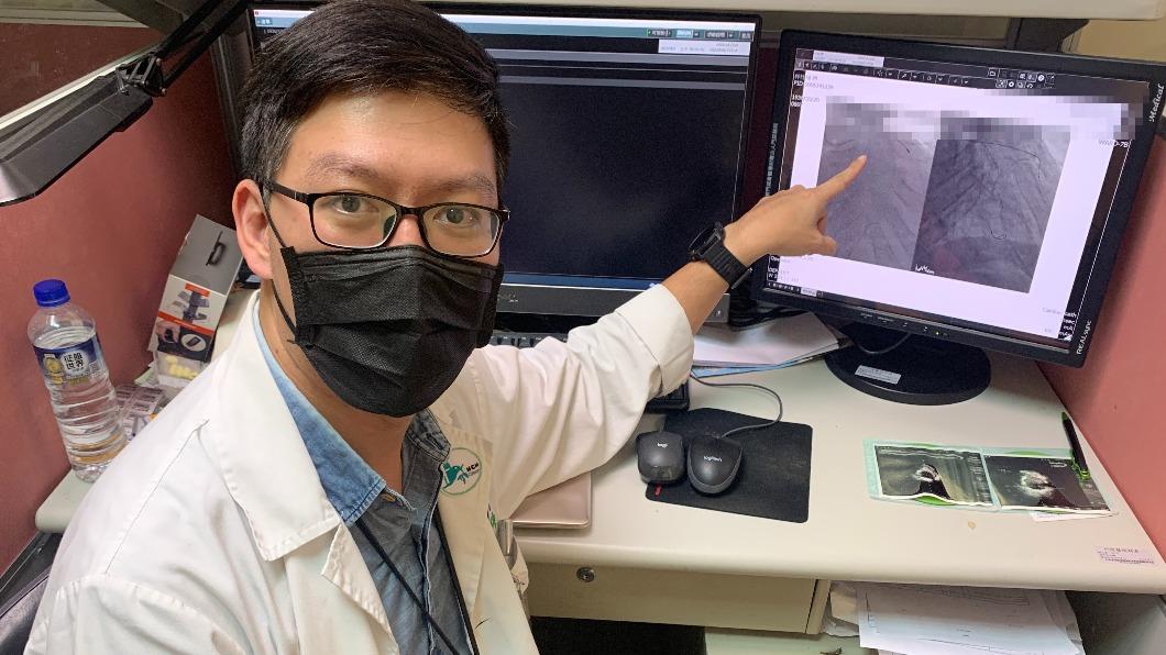 血管嚴重鈣化 冠狀動脈鑽石旋磨術有解