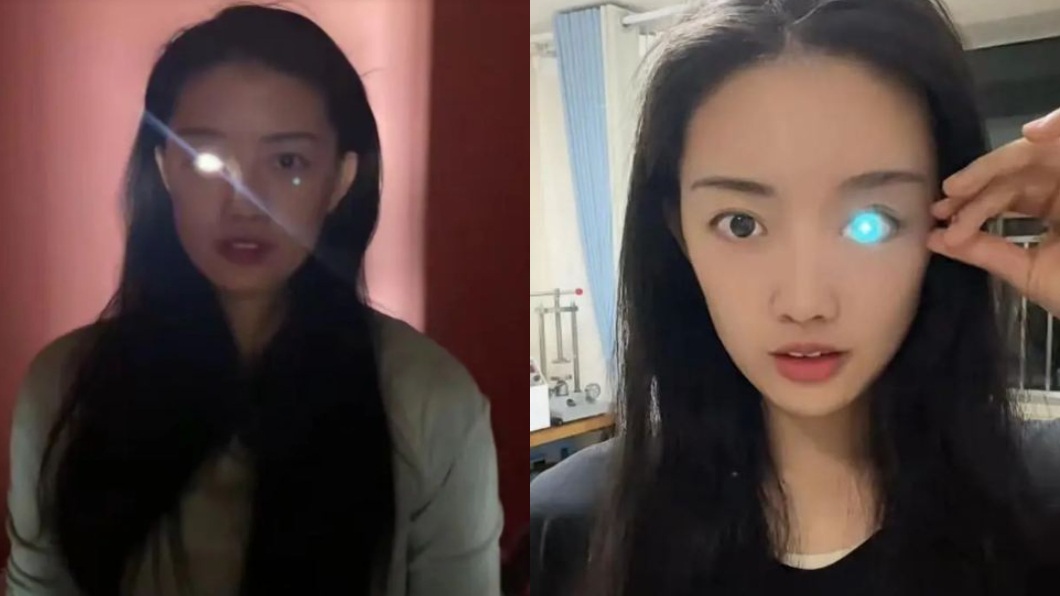 正妹18歲車禍失去右眼 神造「發光義眼」助單眼人