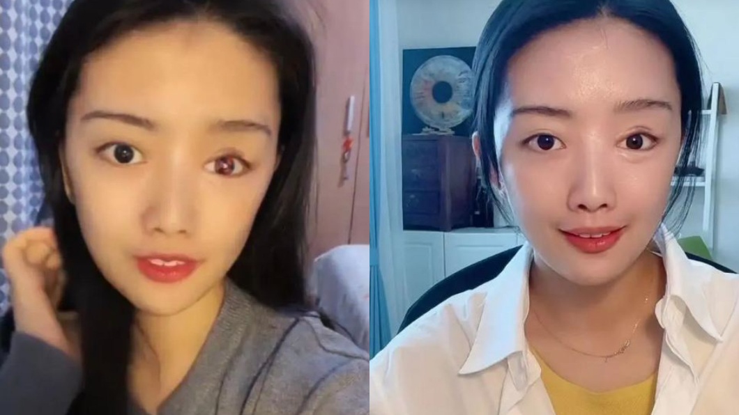 其實若不仔細看還無法察覺正妹眼睛的異狀。(圖/翻攝自新京報)
