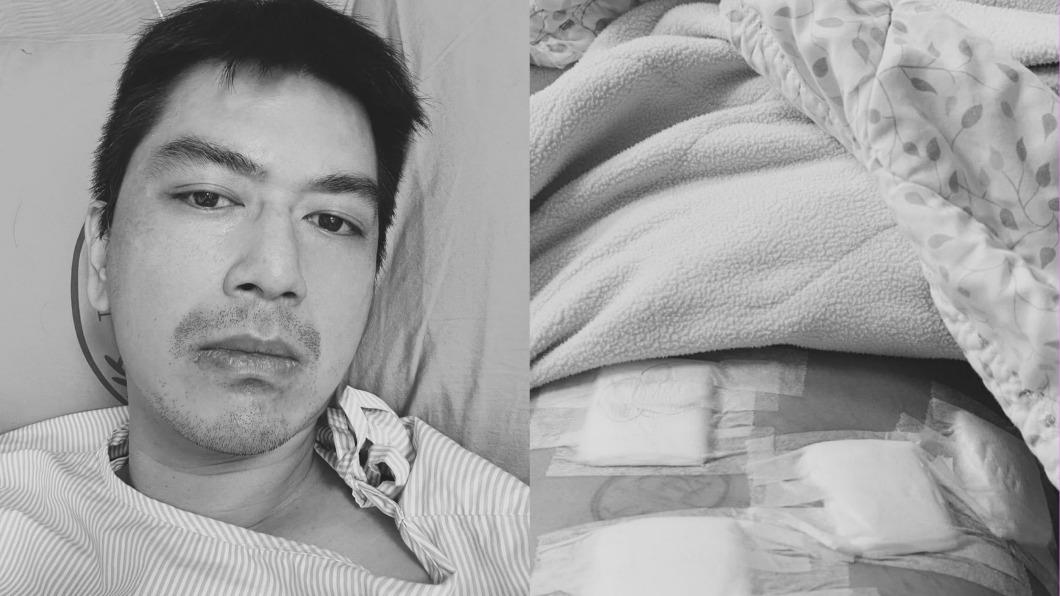 驚爆罹十二指腸腫瘤!台8男神急動刀「肚開4洞」虛弱病況曝