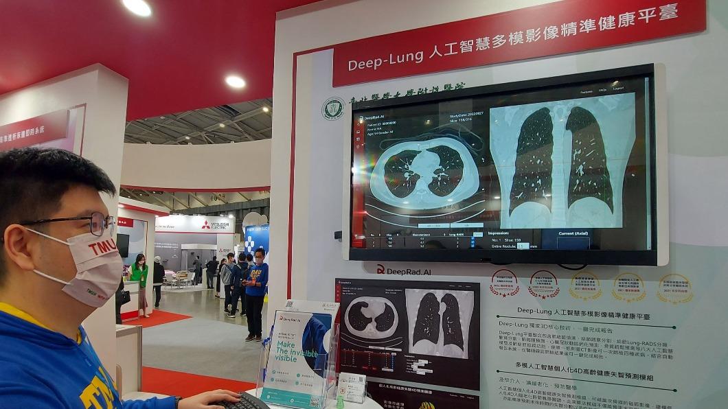照1次CT預測4種疾病!北醫秀AI新技術 機器人醫療大軍上場
