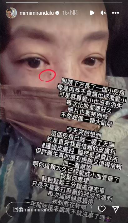 路嘉怡眼下有個小疙瘩,竟然長成了瘤(圖/翻攝自路嘉怡臉書)