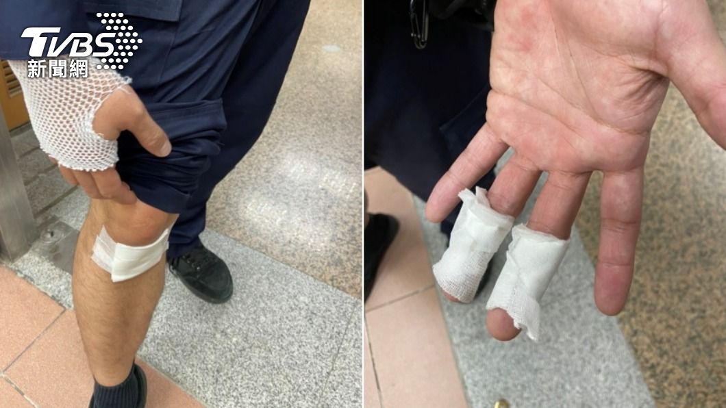 江姓警員手腳有多處擦傷。(圖/TVBS)