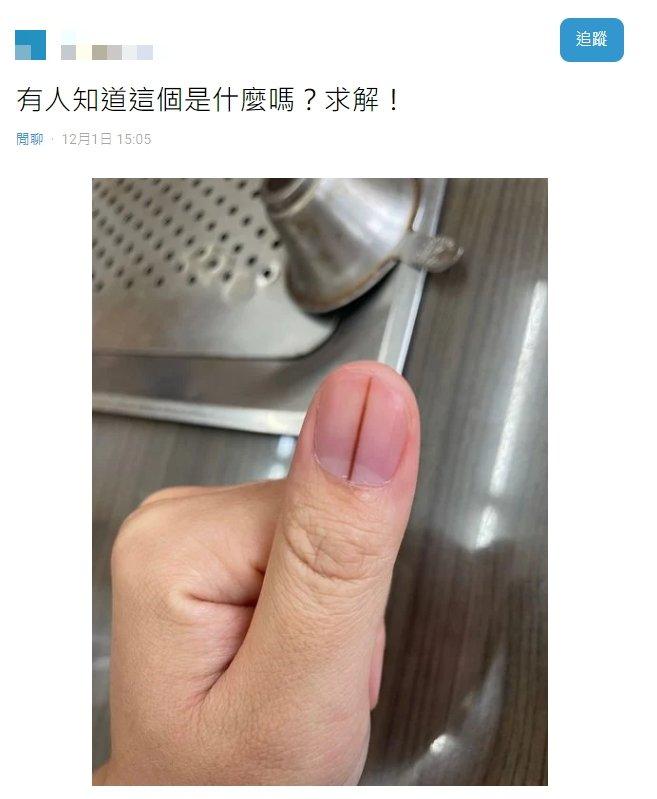 原PO指甲長出黑線,引起討論。(圖/翻攝自Dcard)