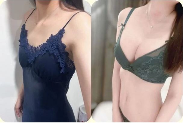 人妻分享隆乳前後。(圖/翻攝自Dcard)
