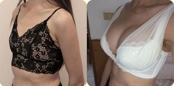 婆婆跟原PO一起去隆乳。(圖/翻攝自Dcard)