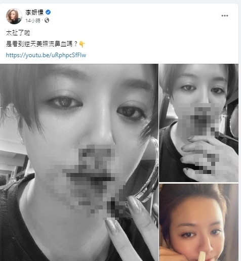女星李妍瑾莫名其妙噴鼻血。（圖／翻攝自李妍瑾臉書）