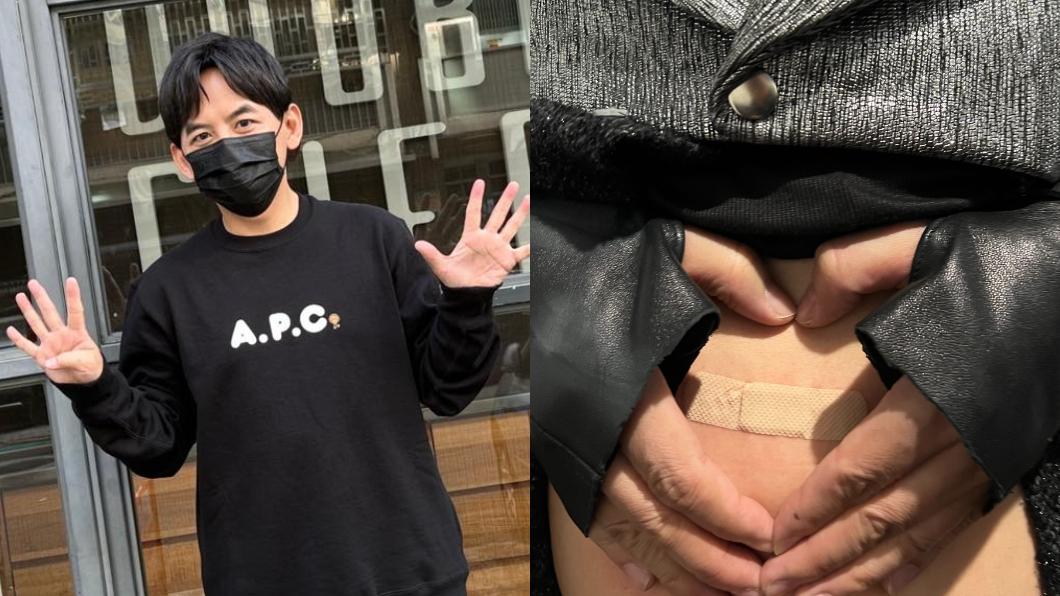 黃子佼直接將暖暖包貼在肚皮上,造成破皮。(圖/翻攝自黃子佼臉書)