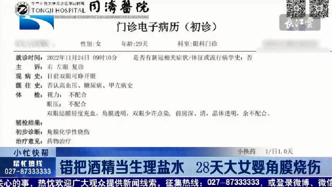 院方診斷女嬰出現雙眼角膜化學性燒傷。(圖/翻攝自微博)